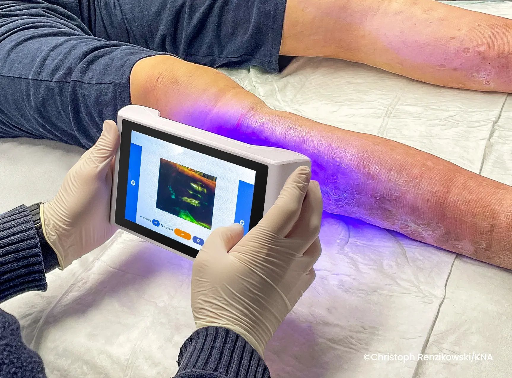 Bakterien-Scan-8-1700-credits_WEBP Bakterien-Scan-8-1700-credits_WEBP