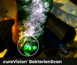 Fuß_BakterienScan_Bearbeitet Fuß_BakterienScan_Bearbeitet