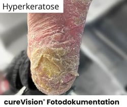 Fuß_normal Fuß_normal