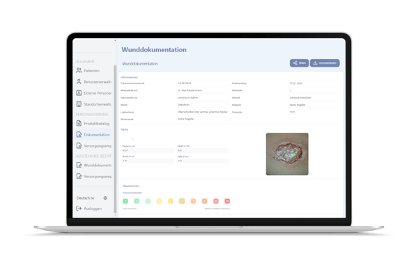 MacBook mit Wundbericht final 1