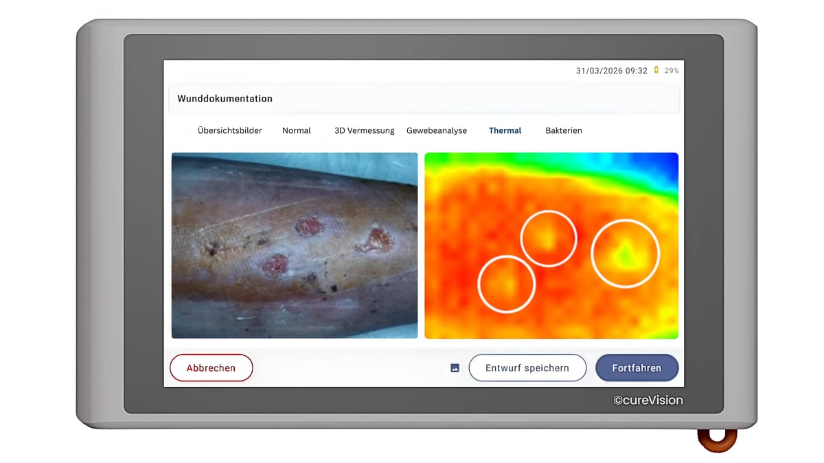 ThermoScan4WebP