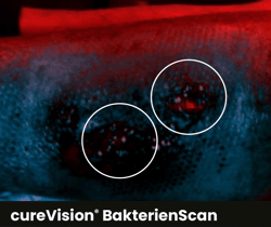 Ulcus_Bearbeitet Ulcus_Bearbeitet