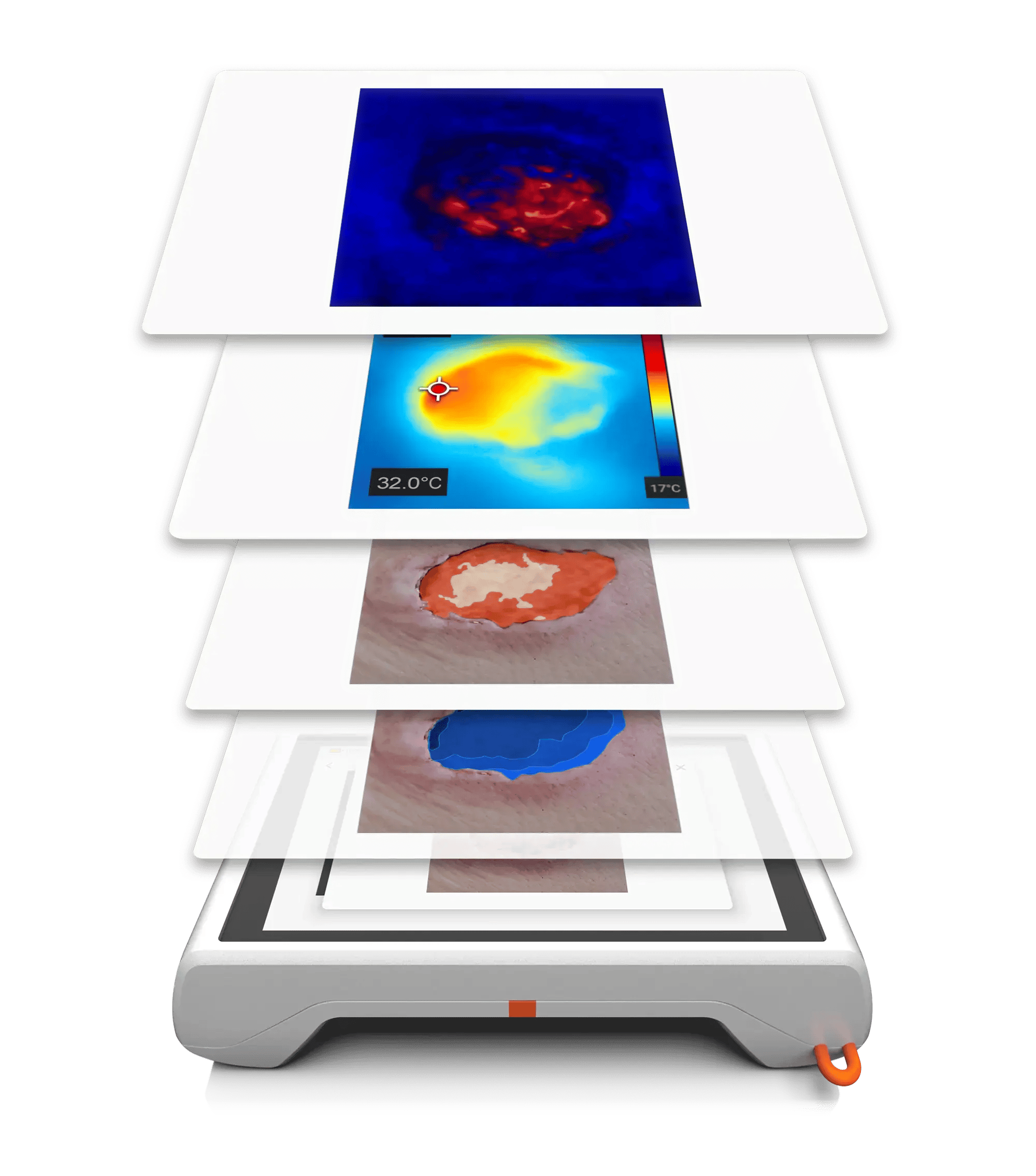 Wundanalyse in Layern_NEU_WebP