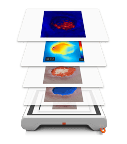 Wundanalyse in Layern_NEU_WebP