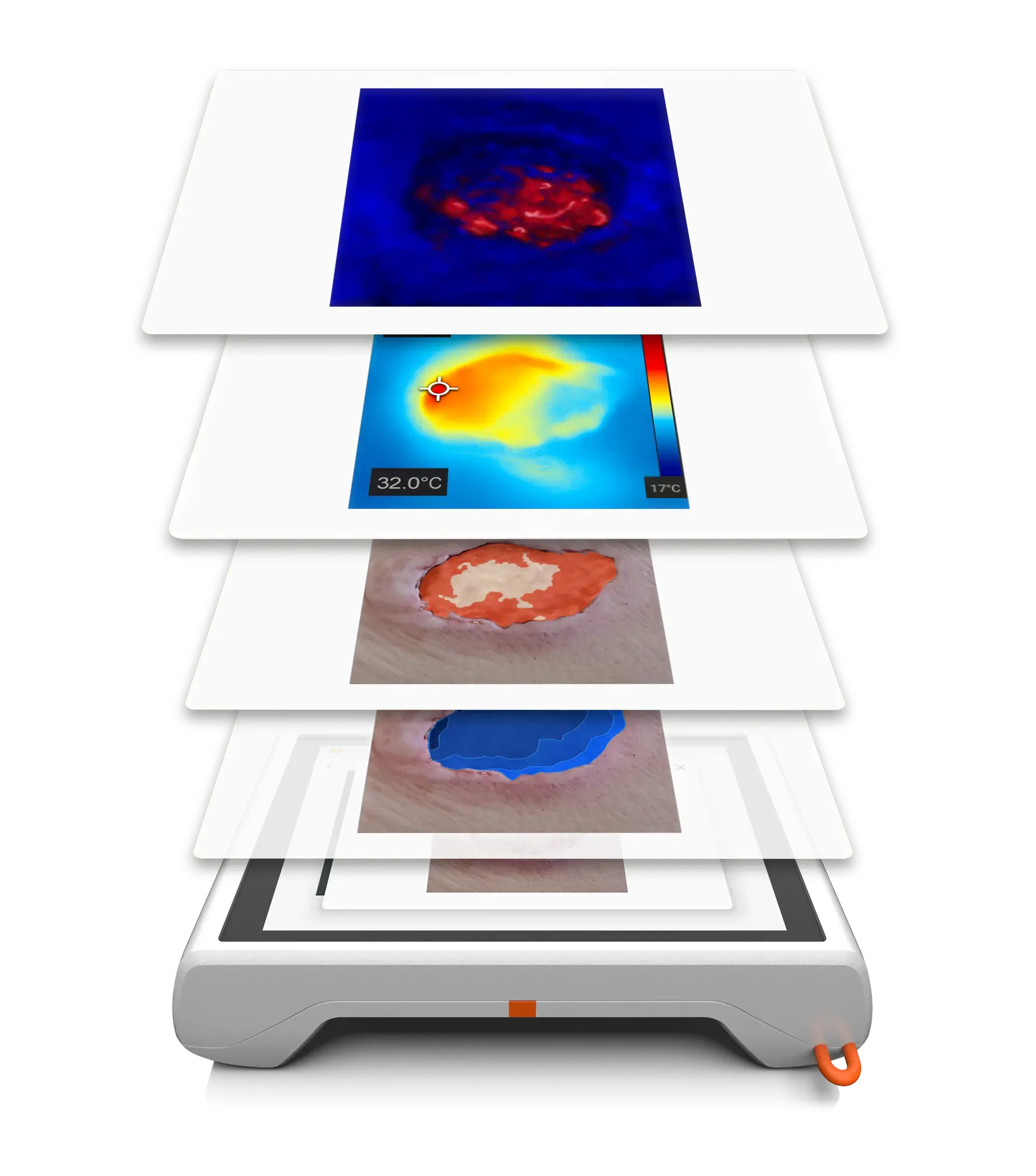Übersicht über die All-in-One Wundanalyse von cureVision